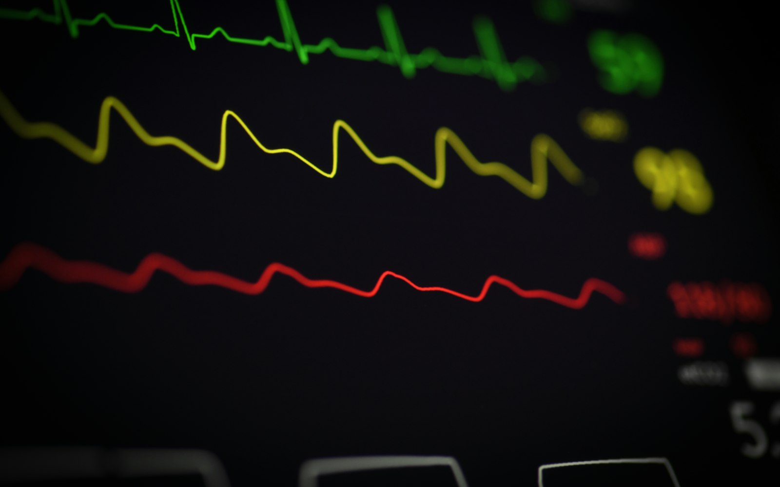 Cardiac rhythm monitoring