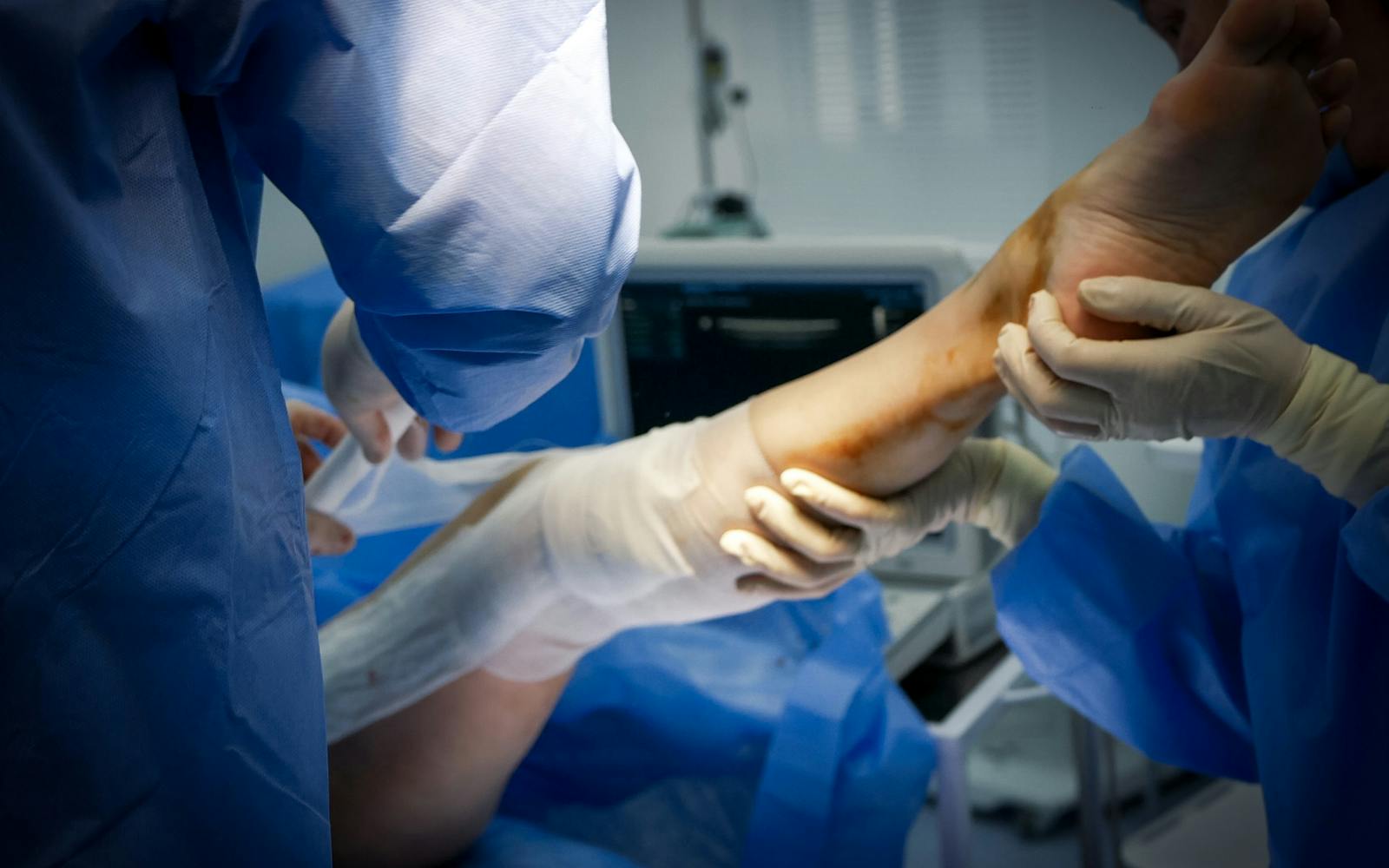 Leg with venous disease before radiofrequency ablation