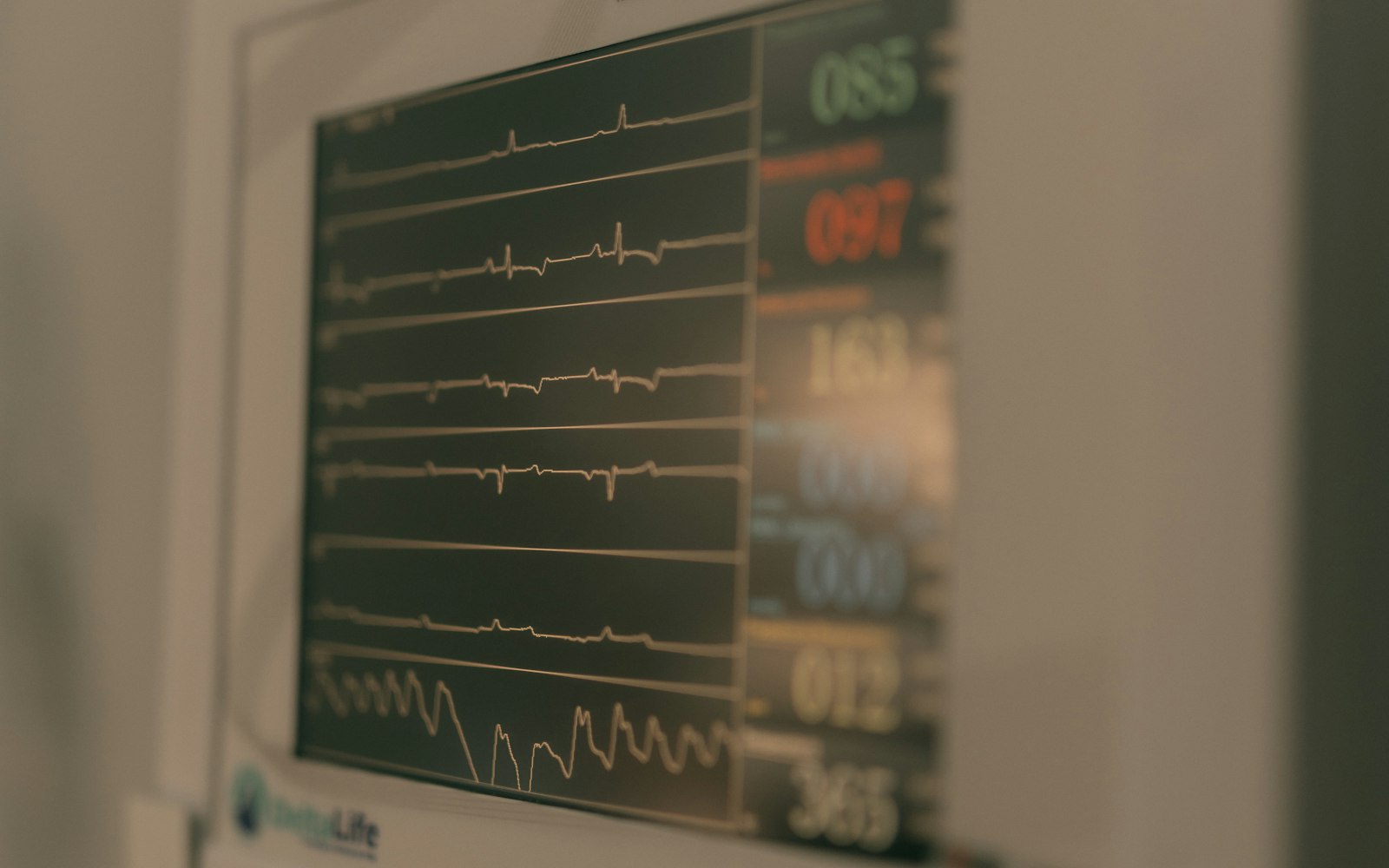 Cardiac monitoring equipment