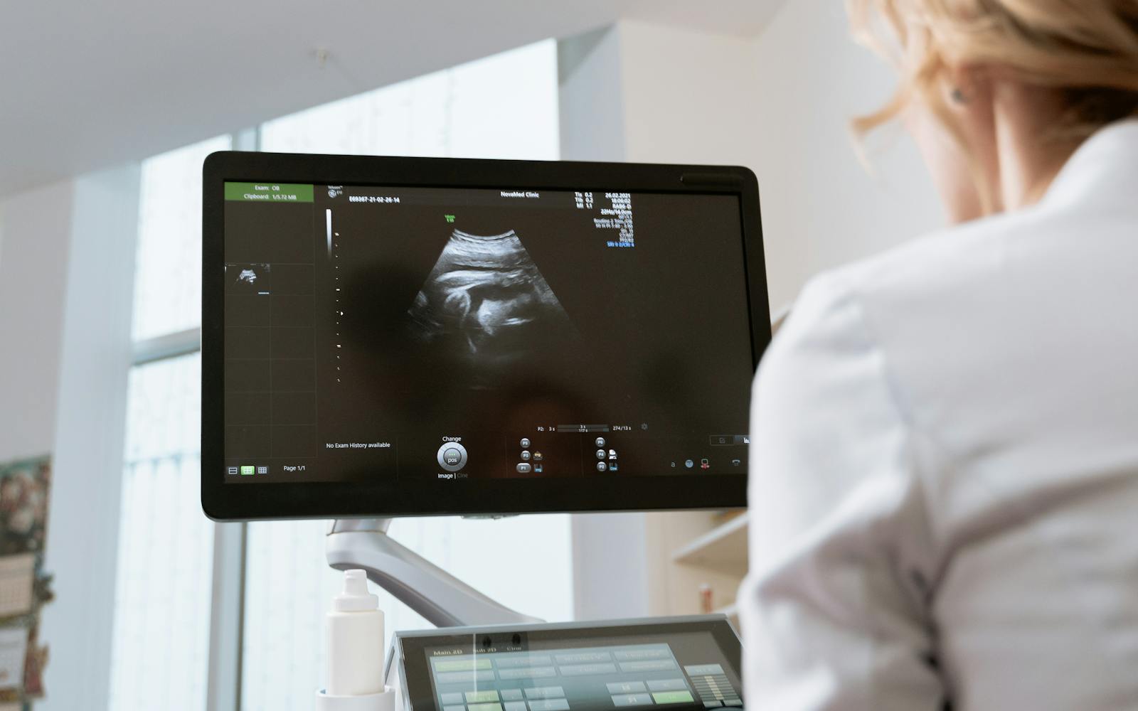 Ultrasound imaging system used for vascular arterial assessment